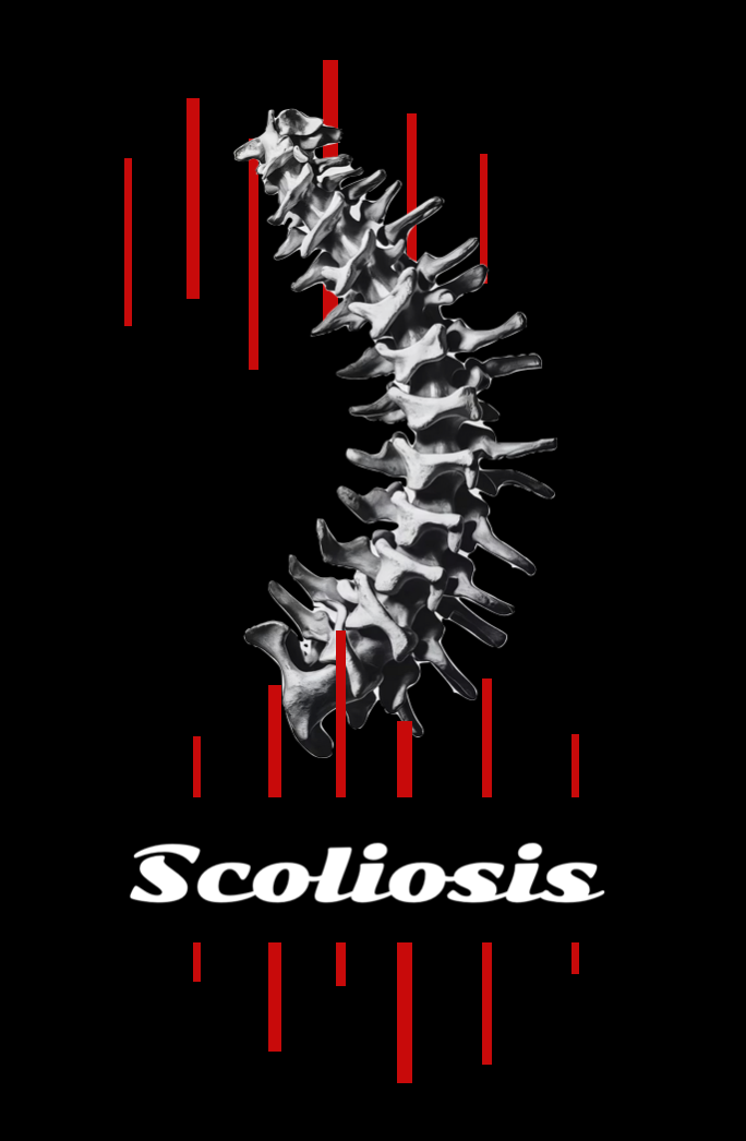 5 Scoliosis